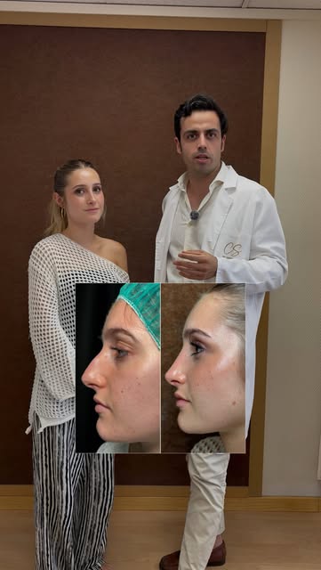 Cover of the closed rhinoplasty video at three months, jointly shared by Clínica Castro Sierra and Dr. Martín Suárez